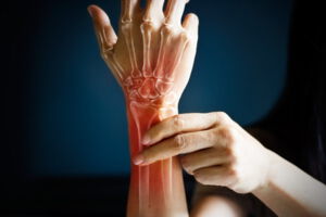 Schmerzen im Handgelenk, Arthrose, Rheuma und Gicht Therapie Köthen